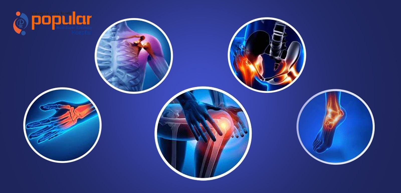 Orthopedics Department in Varanasi